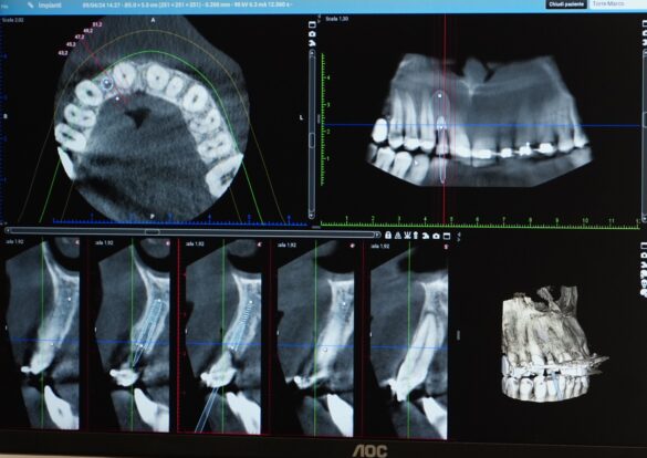 Alta teconolgia odontoiatrica a Taranto